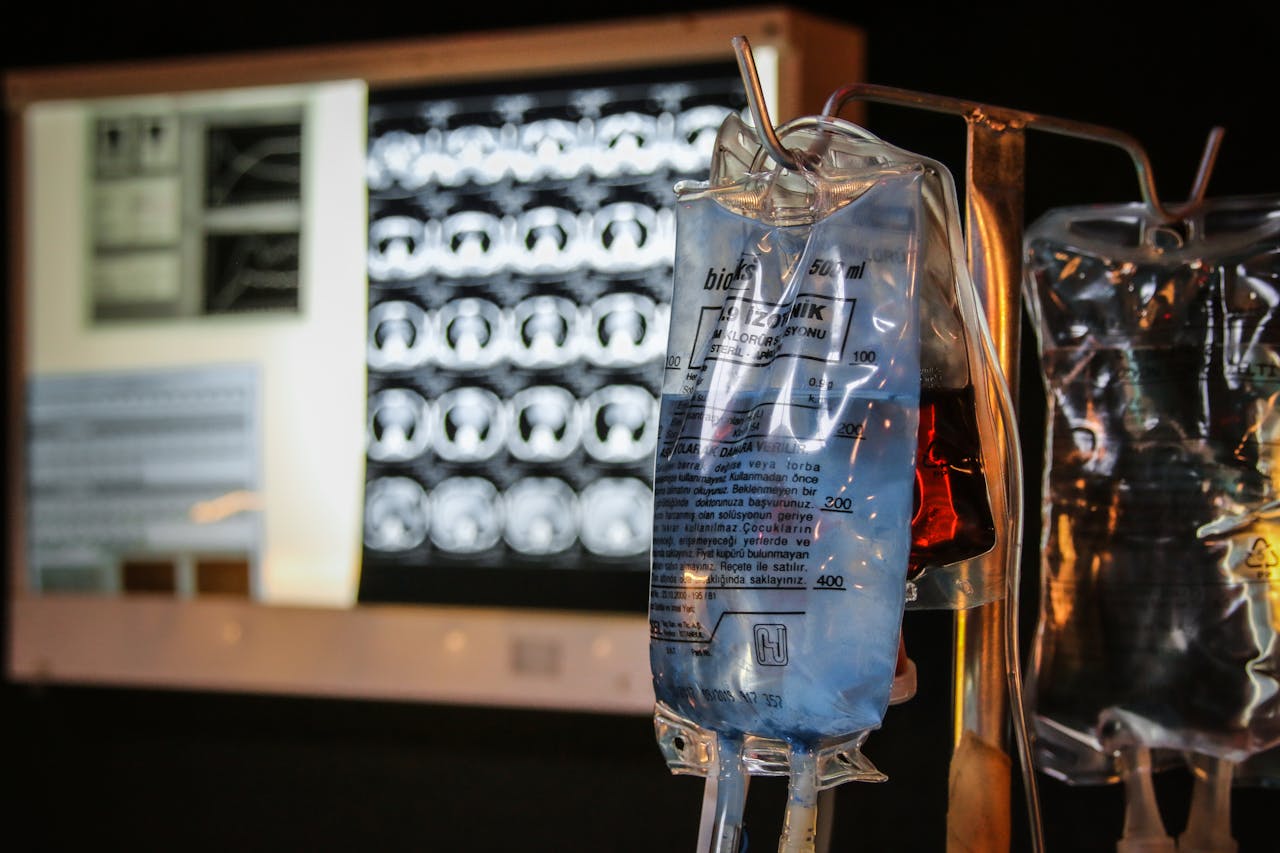 Intravenous fluid bags hanging in front of medical imaging screens in a hospital setting.